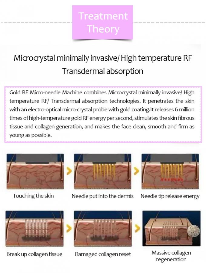 Σαλόνι μείωσης ρυτίδων συσκευών σκλήρυνσης δερμάτων & εξοπλισμός 0 ομορφιάς κλινικών RF