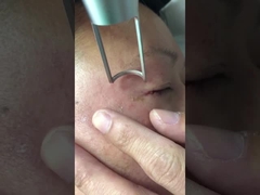 450ps Picosecond μεταστρεφόμενο το Q ND Yag μηχανών 1064nm 532nm λέιζερ