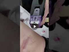 Μηχανή μικροελέτας ραδιοσυχνοτήτων 50W 100V έως 240V