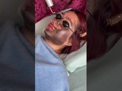 Επένδυση προσώπου 585nm 650nm συσκευή λέιζερ Picosecond 500ps 750ps 2000ps